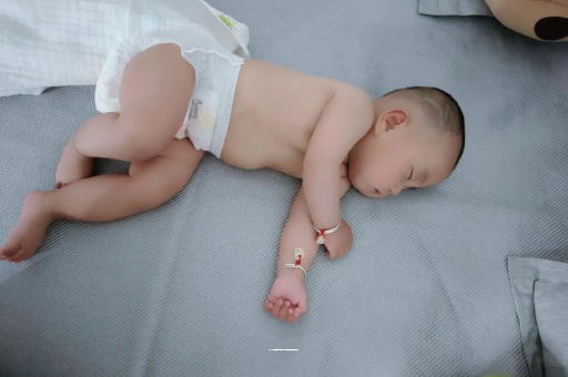 南漳六个月宝宝眼睛散光